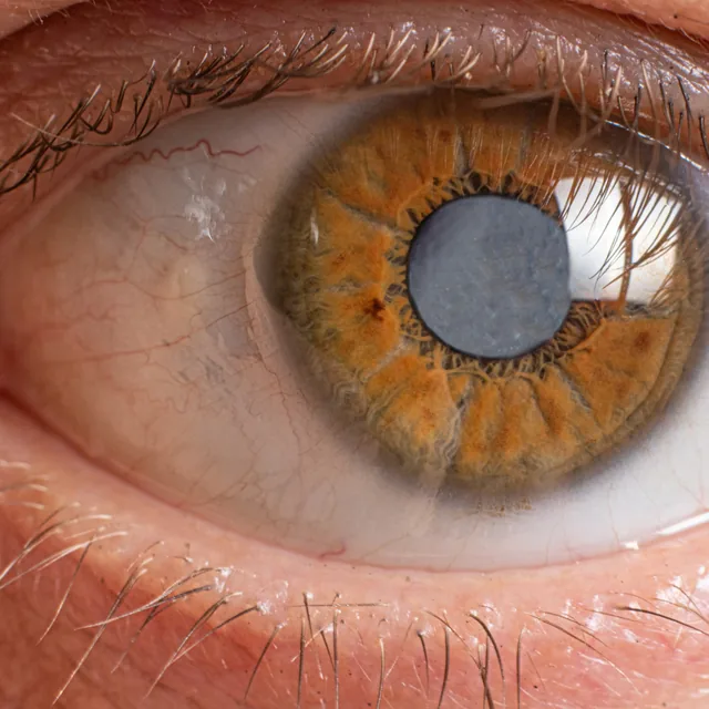 Lentes Cosméticos