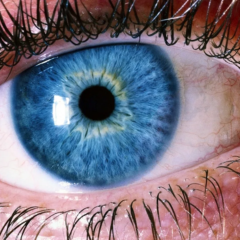 Ojo azul con lente de contacto personalizado